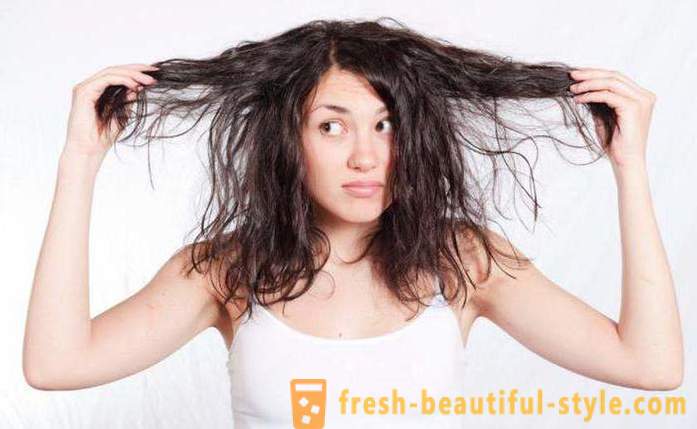 Miks kiire zhirneyut juuksed? Võimalikud põhjused, tunnused ja ravimeetodeid