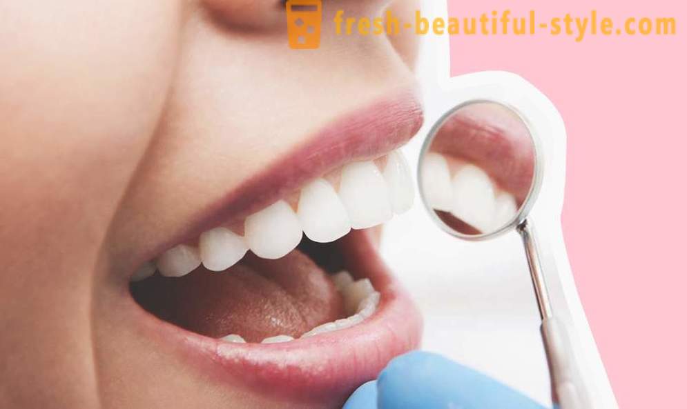 4 küsimusi hambaimplantaate