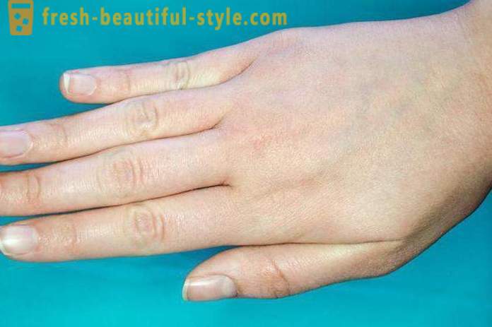 Kestendav nahk näo ja käed: võimalikud põhjused ja tunnused hooldus