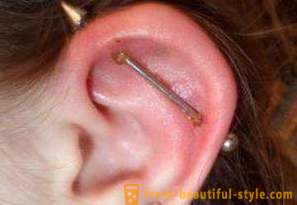 Punkteerimine kõhr kõrva: ravi mõjud