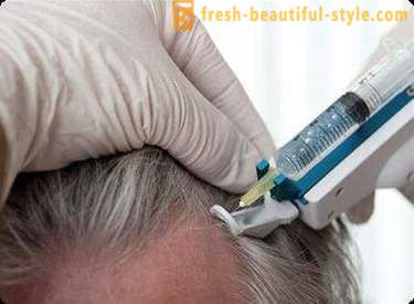 Mesoteraapia juuksed: Makeup tööriistad ja vastunäidustused