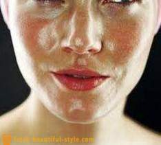 Rasusele nahale nägu: mida teha, et tegeleda probleemi?